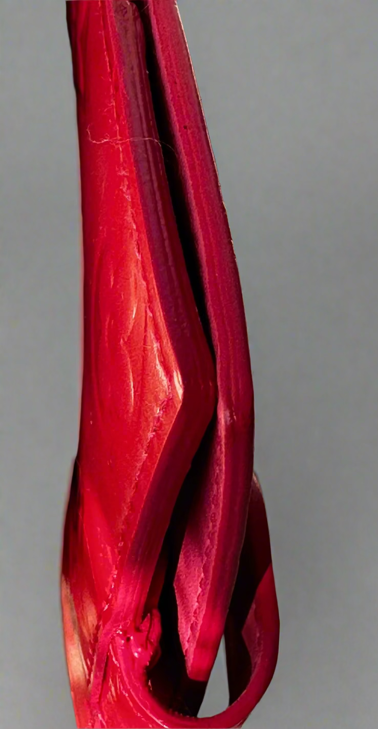 Louis Vuitton Vernis Card Holder in Watermelon/Pommes D'Amour